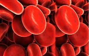Multiple myeloma