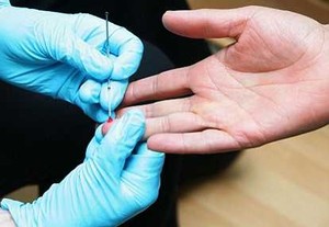 Kadar Kolesterol Terlampau Rendah Bisa Jadi Pertanda Kanker
