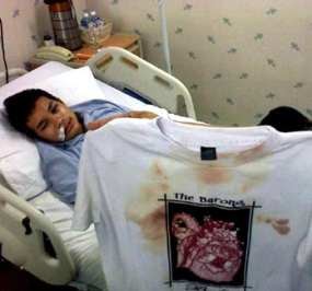 Mulut Ade Masih Sakit Buat Makan