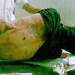 Polisi Minta Keterangan 6 Orang Saksi Mata