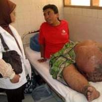 Siangnya Main, Makan Obat Langsung Mencret