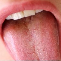 Kebersihan Mulut Pengaruhi Kemampuan Berpikir