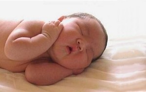 Hipotiroidisme Neonatal