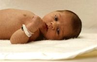 Neonatal Respiratory Distress Syndrome (NRDS)