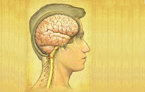 Neurosarcoidosis