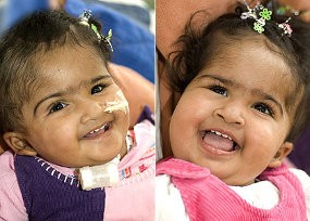 Trishna Sadar dari Koma