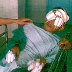 Tersangka Ledakan di Cimahi Ditahan di Mapolres