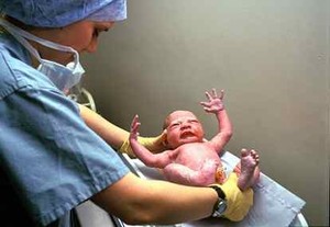 Berat Badan Saat Lahir Tentukan Kapan Anak Puber
