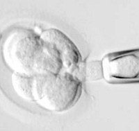 Teknik Memilih Jenis Kelamin Anak