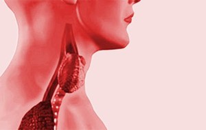 Silent Tiroiditis