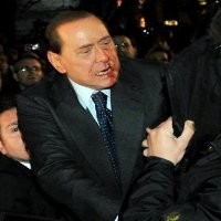 PM Italia Harus Menginap di Rumah Sakit