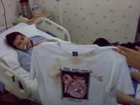 Pihak Korban dan Pelaku Berdamai