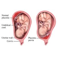 Keputihan Dikehamilan 9 Bulan Ibuhamil Com