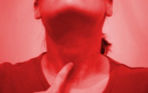 Tiroiditis Subakut