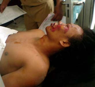 Korban Luka Dirawat di RSUD Tarakan