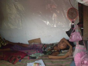 Kisah Rasnawati dengan Tumor di Tubuhnya