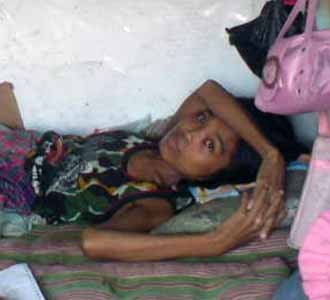 Kisah Rasnawati, Penderita Tumor