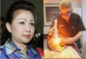 Laser Darah, Rahasia Kulit Mulus ala Artalyta