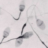 Menelan Sperma Bisa Bikin Awet Muda?