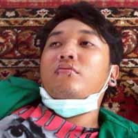3 Mahasiswa Unas Jahit Mulut Sambut 100 Hari Pemerintahan SBY