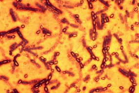 Pakai Heroin Terkontaminasi Anthrax, 8 Orang Tewas