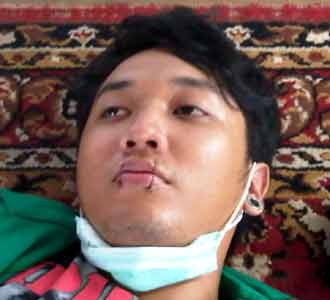 Jahit Mulut Sambut 100 Hari Pemerintahan SBY