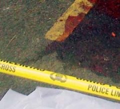 Korban Patah Tulang Lengan Kanan dan Pembengkakan Otak