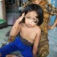 Tubuh Fatihayah Diselimuti Rambut Hitam