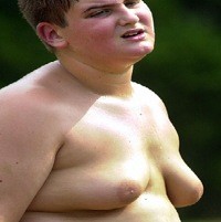 Pria Payudara Besar Ramai-ramai Operasi Kecilkan Dada  