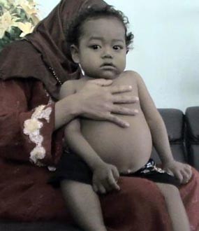 Wartawan Malang Galang Dana Peduli Eka Putra