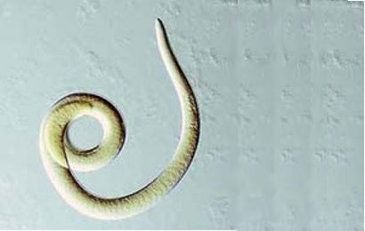 Trichinosis