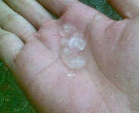 Hujan Es Guyur Bandung