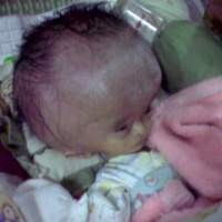 Pasca Operasi, Kepala Toriq Masih Dipasangi Selang
