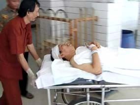 Buang, Korban Kecelakaan Maut Pasuruan Alami Cedera Otak Ringan