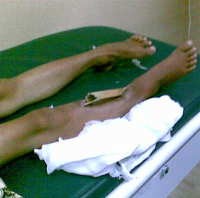 Ayi Tidak Bisa Berlari Kencang