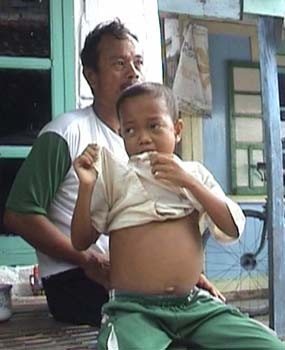 Sering Kambuh, Bastiawan Mengaku Sering Makan Genting