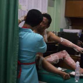 Bakar Rokok Dekat Tiner, Tiga Pekerja Pabrik Terbakar