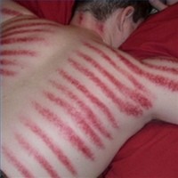 Adakah Penyakit Masuk Angin?