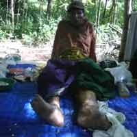 Dibuatkan Tempat Berteduh, Penderita Kusta Bisa Sarapan