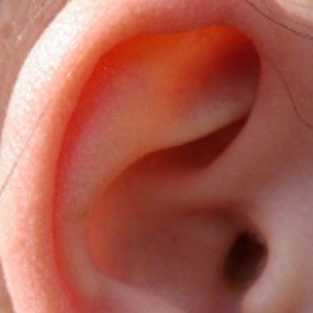 Mampu Mendengar Saat Bising Itu Berkat Peran Otak