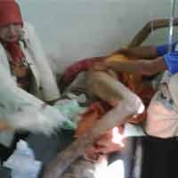 Penderita Kusta Mengaku Bisa Tidur Nyenyak