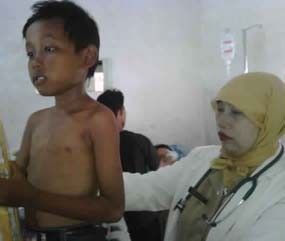 Kusta Fani Dirawat dan Diobati