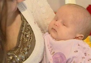 USG Gagal Deteksi Bayi Tanpa Mata