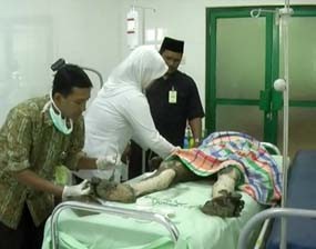 Kompor Meledak, Pasutri Alami Luka Bakar