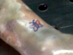  Korban Mutilasi Bergolongan Darah A