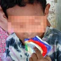 Fenomena Eri, Bocah Kediri Pemakan Sabun