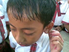 Lagi, Guru Aniaya Murid di Pacitan 