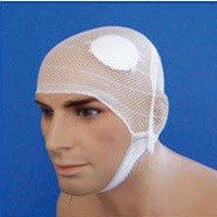 Geger Otak dan Hilang Ingatan