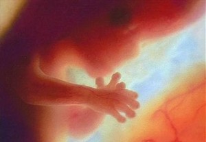 Kondisi Ibu Hamil di Trimester Pertama (1)