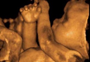 Kondisi Ibu Hamil di Trimester Ketiga (3)